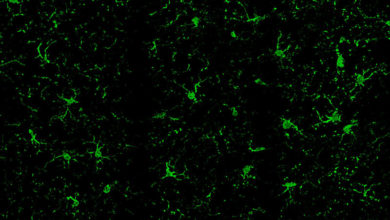 Foto de Estudo aponta para um novo papel da microglia na síndrome de Down