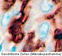 Foto de Células dendríticas